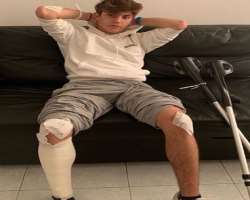 Mazzei met an accident in October 2019 and got his calf torn and some bruises.